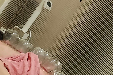 Shanghai: Chinese Medicine Acupuncture and Cupping Session