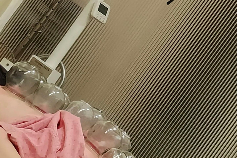 Shanghai: Chinese Medicine Acupuncture and Cupping Session