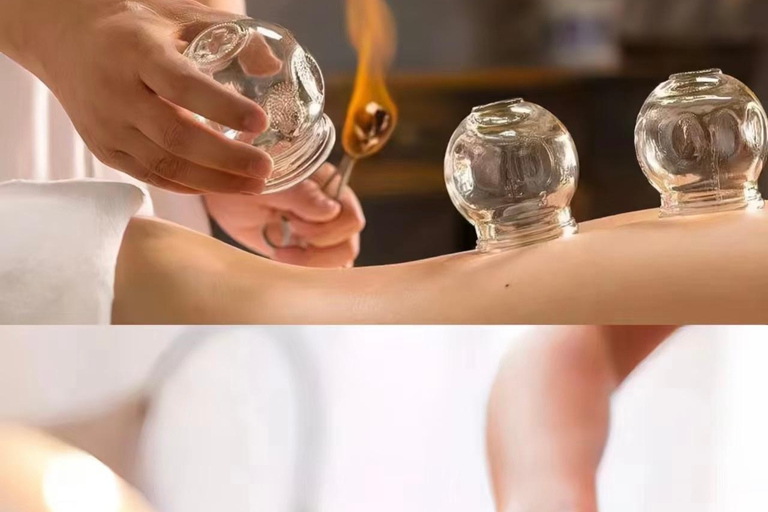 Shanghai: Chinese Medicine Acupuncture and Cupping Session