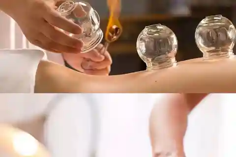 Shanghai : séance d'acupuncture et de ventouses selon la médecine chinoise