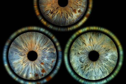 Stockholm: Reveal Your Eye Experience at the Iris Galerie