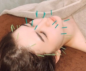 Tóquio：Experiência luxuosa de acupunctura de beleza
