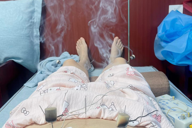 Shanghai: Chinese Medicine Acupuncture and Cupping Session