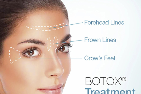 Tbilisi: Private Full-Face Botox with Hotel Pickup, optional