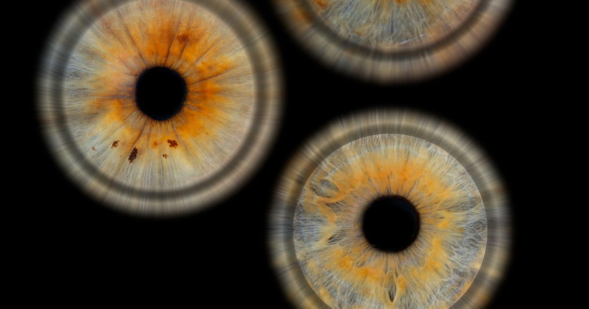 Photo Iris: Discover the unique beauty of your eyes | GetYourGuide
