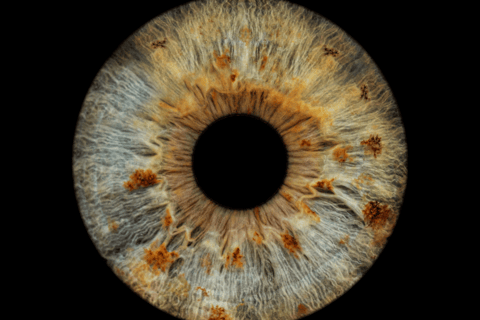 Cappadocia: Personal Eye-Iris Photography Experience