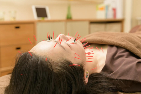 Hiroshima: Acupuncture and Chiropractic Treatment 【90min】Hiroshima: Acupuncture and Chiropractic Treatment